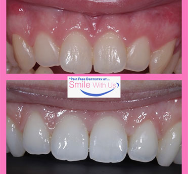 Smile Gallery Image
